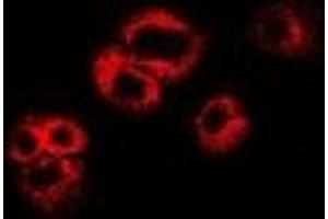 Immunofluorescent analysis of WIF-1 staining in U2OS cells. (WIF1 抗体)