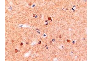 ABIN2563481 (2µg/ml) staining of paraffin embedded Human Brain. (CD11b 抗体  (Internal Region))
