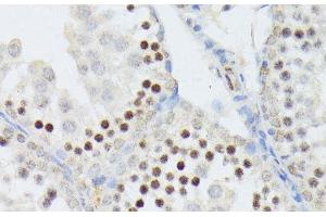 Immunohistochemistry of paraffin-embedded Mouse testis using ANKRD52 Polyclonal Antibody at dilution of 1:100 (40x lens). (ANKRD52 抗体)