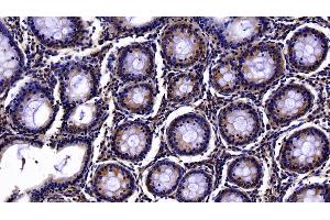 Detection of PON1 in Human Colon Tissue using Polyclonal Antibody to Paraoxonase 1 (PON1) (PON1 抗体  (AA 35-206))