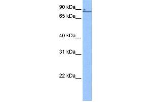 WB Suggested Anti-ZNF432 Antibody Titration:  0. (ZNF432 抗体  (N-Term))