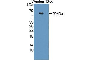 Western blot analysis of the recombinant protein. (THRA 抗体  (AA 1-490))