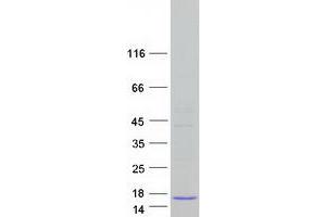 Western Blotting (WB) image for ADP-Ribosylation Factor-Like 9 (ARL9) protein (Myc-DYKDDDDK Tag) (ABIN2714919)