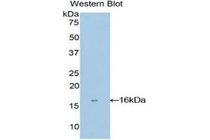 Western blot analysis of recombinant Human MGP. (MGP 抗体  (AA 1-103))