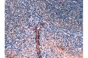 Detection of Ub in Human Tonsil Tissue using Monoclonal Antibody to Ubiquitin (Ub)