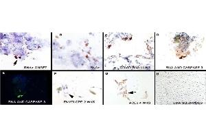 IHC Validation in COVID-19 Patient Sample: (Nuovo et al. (SARS-CoV-2 Envelope 抗体  (N-Term))