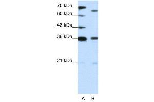 WB Suggested Anti-PRDM13  Antibody Titration: 1. (PRDM13 抗体  (C-Term))