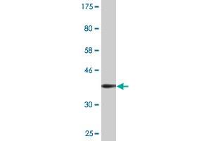 Western Blot detection against Immunogen (36. (PHOSPHO1 抗体  (AA 168-266))