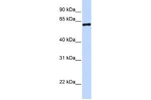 Western Blotting (WB) image for anti-Cleavage Stimulation Factor, 3' Pre-RNA, Subunit 2, 64kDa (CSTF2) (N-Term) antibody (ABIN2778764)