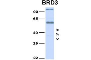 Host:  Rabbit  Target Name:  BRD3  Sample Type:  Human Fetal Lung  Antibody Dilution:  1.
