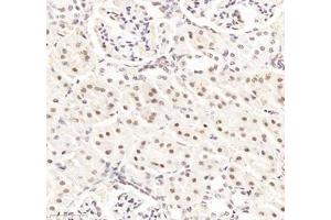 Immunohistochemistry of paraffin embedded rat kidney using RBM8A (ABIN7075478) at dilution of 1: 300 (300x lens)