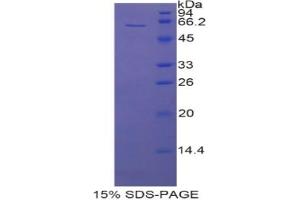 SDS-PAGE analysis of Rat CD5L Protein. (CD5L 蛋白)