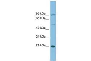 DNAJC12 Antikörper  (C-Term)