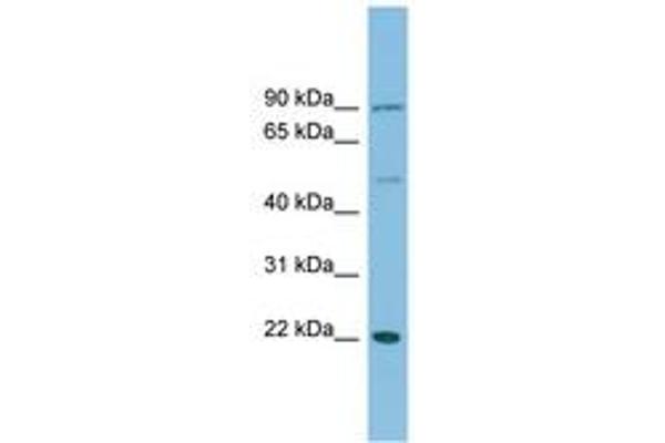 DNAJC12 抗体  (C-Term)