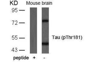 Western blot analysis of extracts from mouse brain tissue using Tau(Phospho-Thr181) Antibody and the same antibody preincubated with blocking peptide. (MAPT 抗体  (pThr181))