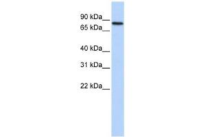 ADARB2 antibody used at 1 ug/ml to detect target protein. (ADARB2 抗体)