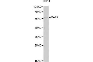 Western blot analysis of extracts of THP-1 cells, using MATK antibody. (MATK 抗体)