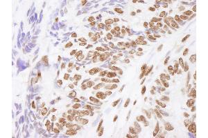 Immunohistochemistry (IHC) image for anti-Matrin 3 (MATR3) (C-Term) antibody (ABIN7448986)