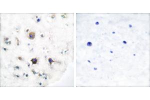 Peptide - +Immunohistochemical analysis of paraffin-embedded human brain tissue using Ephrin-B3 antibody (#C0182). (Ephrin B3 抗体)