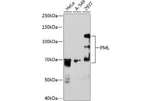 Western blot analysis of extracts of various cell lines, using PML antibody (ABIN7269565) at 1:1000 dilution. (PML 抗体)