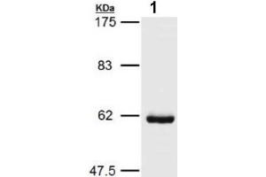 Western blot analysis of HSP60 expression in COLO205 cells