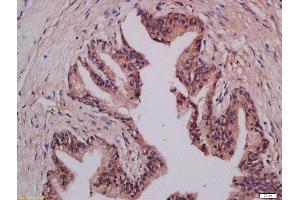 Formalin-fixed and paraffin embedded human prostate tissue labeled with Anti-LMAN1 Polyclonal Antibody, Unconjugated  at 1:300 followed by conjugation to the secondary antibody and DAB staining. (LMAN1 抗体  (AA 31-130))