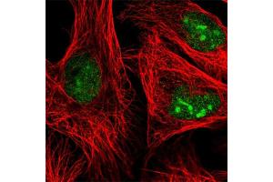 Immunofluorescent staining of human cell line U-2 OS with ADAR polyclonal antibody  at 1-4 ug/mL concentration shows positivity in nucleoli and nucleus but excluded from the nucleoli. (ADAR 抗体)