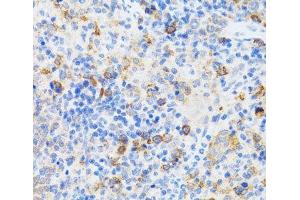 Immunohistochemistry of paraffin-embedded Mouse spleen using CHAF1B Polyclonal Antibody at dilution of 1:100 (40x lens).