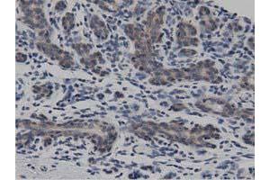 Immunohistochemical staining of paraffin-embedded Human breast tissue using anti-DNAJA2 mouse monoclonal antibody. (DNAJA2 抗体)