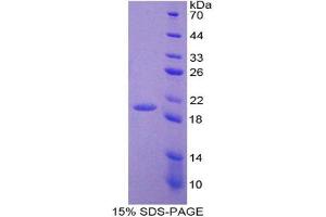 SDS-PAGE analysis of Human ADM Protein. (Adrenomedullin Protein (ADM))
