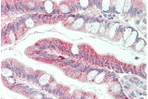 Human Small Intestine: Formalin-Fixed, Paraffin-Embedded (FFPE) (FZD5 抗体  (AA 461-510))
