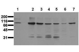 Western Blotting (WB) image for anti-Catenin (Cadherin-Associated Protein), beta 1, 88kDa (CTNNB1) (Core) antibody (ABIN126748) (CTNNB1 抗体  (Core))