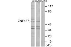 Western blot analysis of extracts from Jurkat/HuvEc cells, using ZNF187 Antibody. (ZNF187 抗体  (AA 51-100))