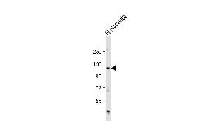 Anti-AD Antibody (Center) at 1:1000 dilution + human placenta lysate Lysates/proteins at 20 μg per lane. (ADAM19 抗体  (AA 207-236))