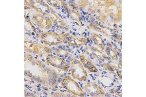 Immunohistochemistry of paraffin-embedded human kidney using ITGB5 antibody at dilution of 1:200 (x400 lens) (Integrin beta 5 抗体  (AA 490-720))