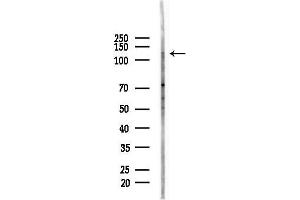 Western blot analysis of lysates from HUVEC cells(starvation,24h treatment), using C Antibody at 1/1000 dilution.
