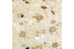 Immunohistochemical analysis of NTR1 staining in human brain formalin fixed paraffin embedded tissue section. (NTSR1 抗体)