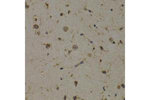 Immunohistochemistry of paraffin-embedded mouse brain using EEF1D antibody at dilution of 1:200 (400x lens). (EEF1D 抗体)