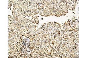 IHC analysis of HP using anti-HP antibody (ABIN7600401).