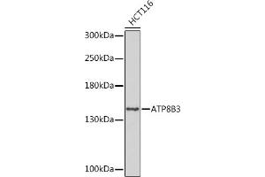 ATP8B3 抗体  (AA 600-900)
