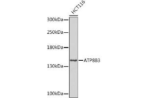 Western blot analysis of extracts of HCT116 cells, using B3 Rabbit pAb (ABIN7265751) at 1:1000 dilution. (ATP8B3 抗体  (AA 600-900))
