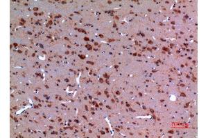 Immunohistochemistry (IHC) image for anti-Heat Shock Protein 90 (HSP90) (Lys284), (Lys292) antibody (ABIN3187840)