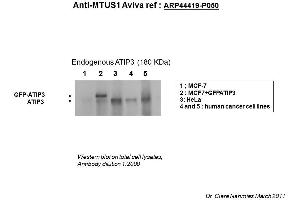 Image no. 2 for anti-Microtubule Associated Tumor Suppressor 1 (MTUS1) (Middle Region) antibody (ABIN502510) (MTUS1 抗体  (Middle Region))
