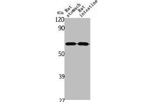 Western Blot analysis of rat stomach rat intestines cells using Angptl1 Polyclonal Antibody (ANGPTL1 抗体  (N-Term))