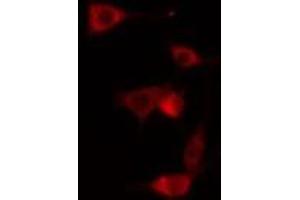 ABIN6275056 staining NIH-3T3 cells by IF/ICC. (DHPS 抗体  (Internal Region))