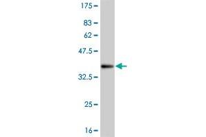 Western Blot detection against Immunogen (35. (WT1 抗体  (AA 349-439))