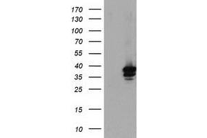 HEK293T cells were transfected with the pCMV6-ENTRY control (Left lane) or pCMV6-ENTRY SDS (Right lane) cDNA for 48 hrs and lysed. (serine Dehydratase 抗体)