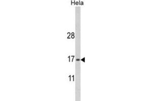 Western Blotting (WB) image for anti-MpV17 Mitochondrial Inner Membrane Protein (MPV17) antibody (ABIN3003896) (MPV17 抗体)