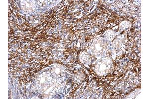 IHC-P Image ITI-H3 antibody [N1N3] detects ITI-H3 protein at secreted on mouse cervix by immunohistochemical analysis. (ITIH3 抗体)
