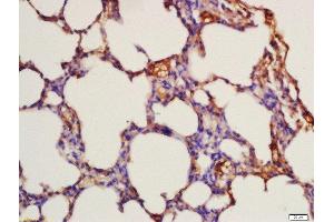 Formalin-fixed and paraffin embedded rat lung labeled with Rabbit Anti-FLT3 (Tyr842) Polyclonal Antibody, Unconjugated  at 1:200 followed by conjugation to the secondary antibody and DAB staining (FLT3 抗体  (pTyr842))